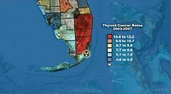 Thyroid cancer